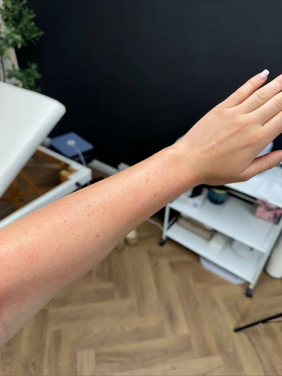 Smooth forearm straight after a wax in the Andover salon