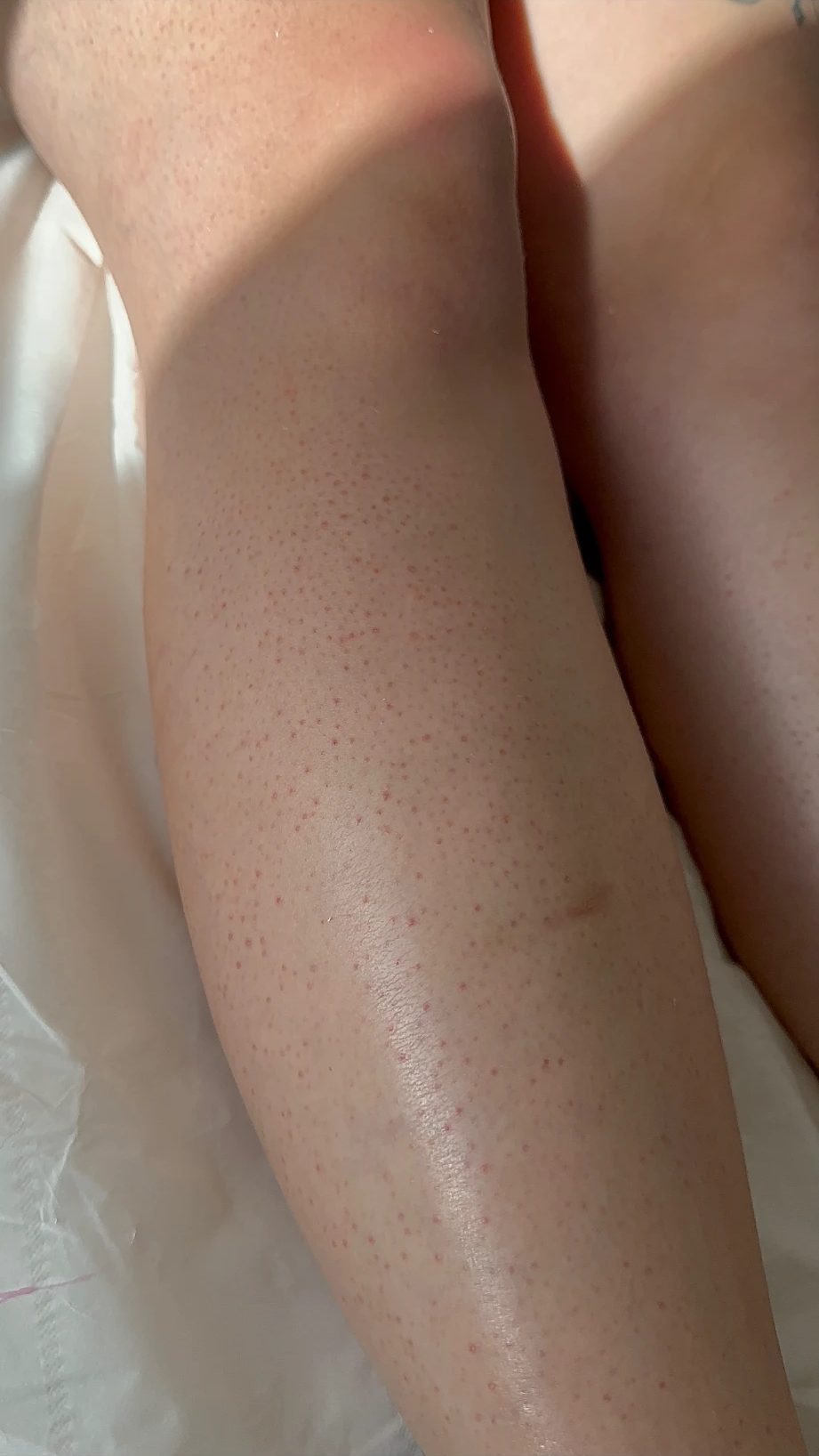 Lower leg straight after a wax