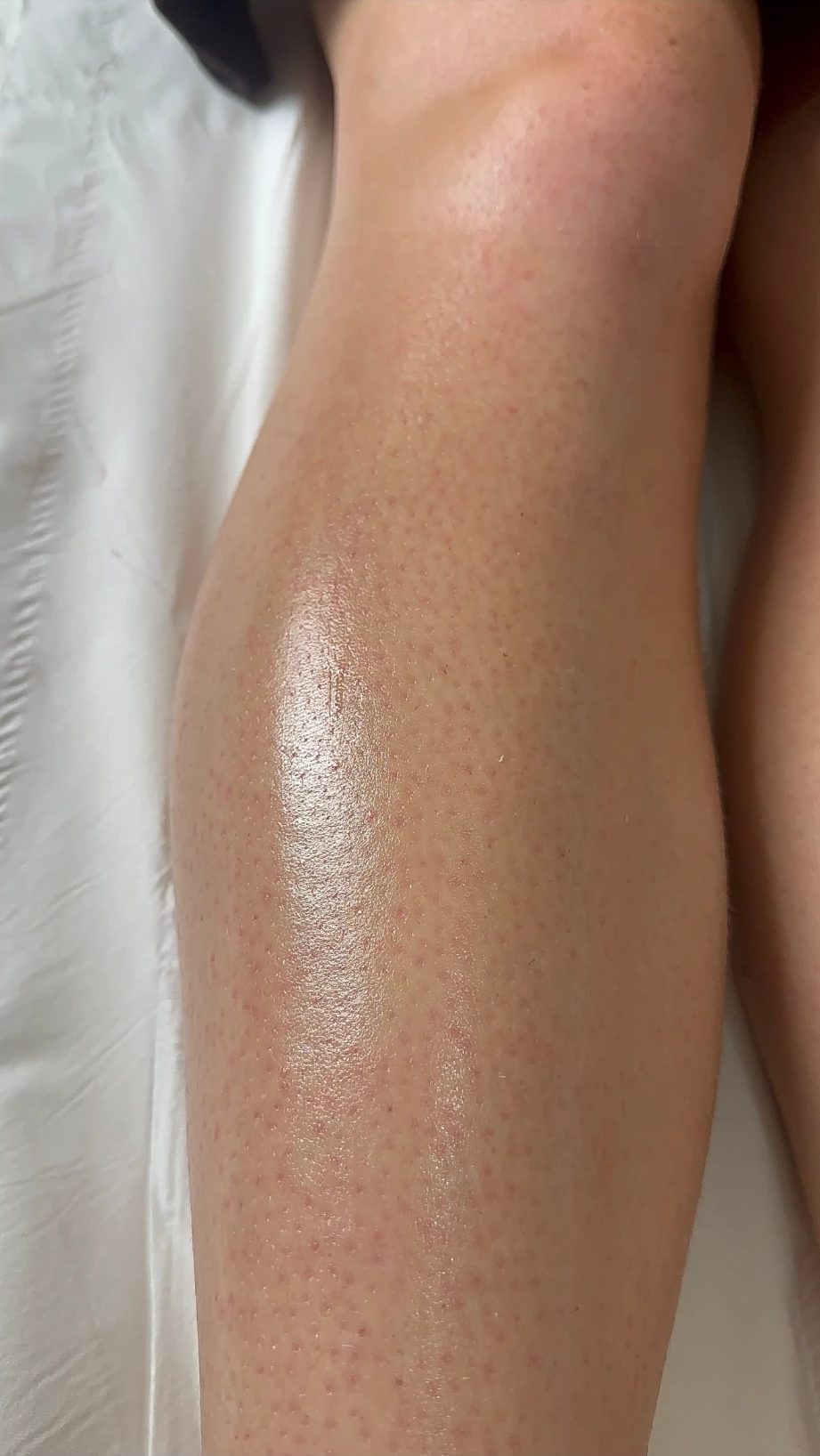 Calf straight after a wax