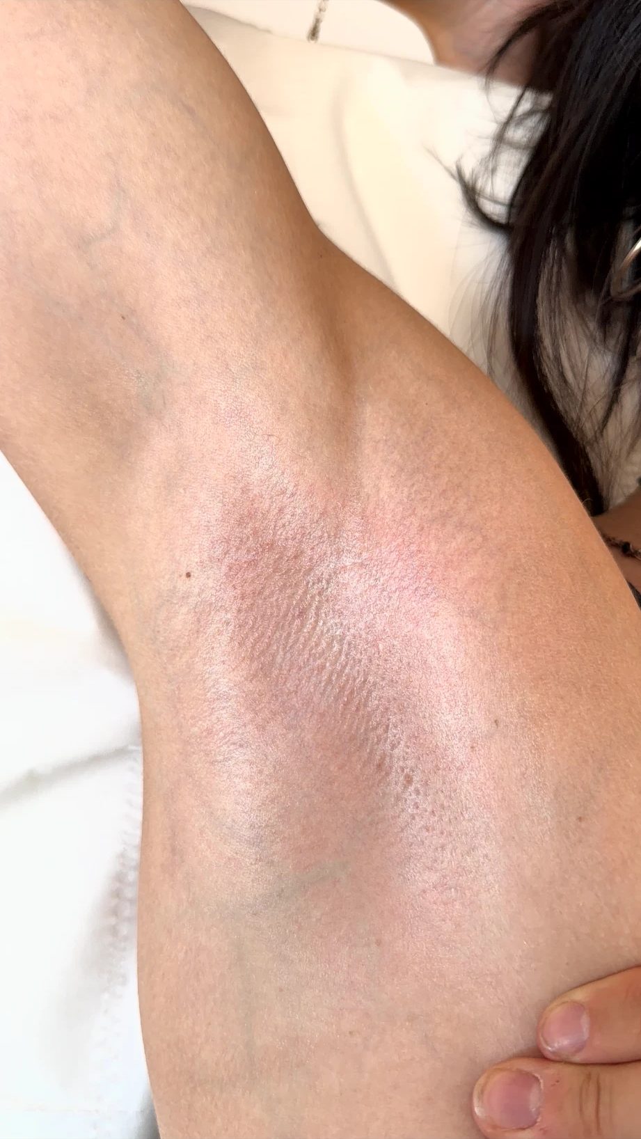 Underarm straight after a wax