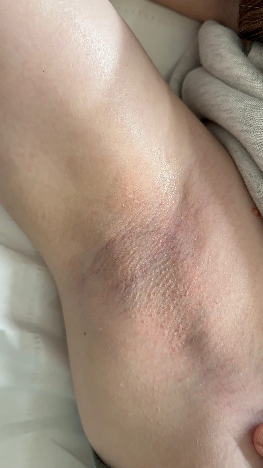 Underarm straight after a wax